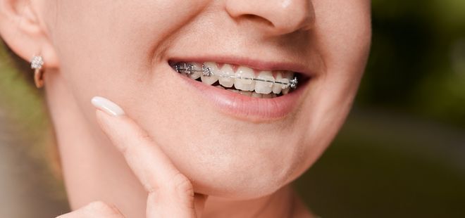 Estética Dental. Ortodoncia en Cantillana