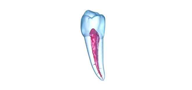 Endodoncia de premolares en Cantillana